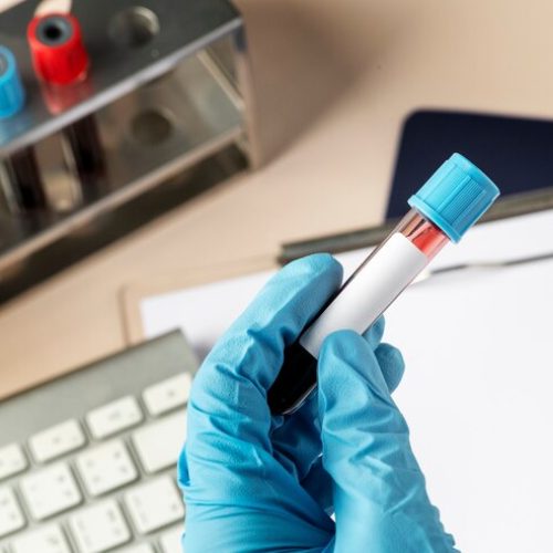 إمكانية الفحص في المنزل